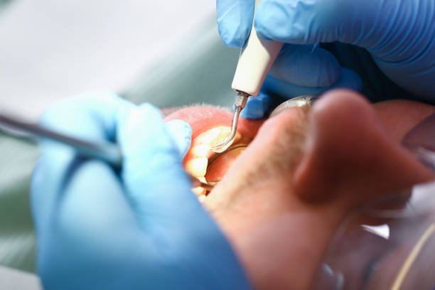Best Emergency Treatment for Toothache in Penn Valley, CA